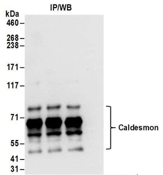 Rabbit anti-Caldesmon Antibody, Affinity Purified