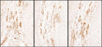 Rabbit anti-Caldesmon Antibody, Affinity Purified
