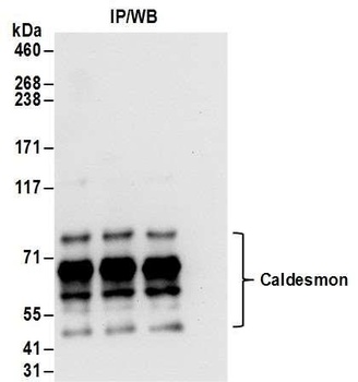 Rabbit anti-Caldesmon Antibody, Affinity Purified