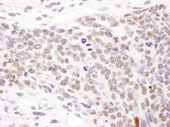 Rabbit anti-Phospho SMC1 (S957) Antibody, Affinity Purified