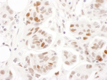 Rabbit anti-Phospho SMC1 (S957) Antibody, Affinity Purified