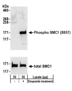 Rabbit anti-Phospho SMC1 (S957) Antibody, Affinity Purified