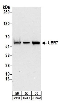 Rabbit anti-UBR7 Antibody, Affinity Purified