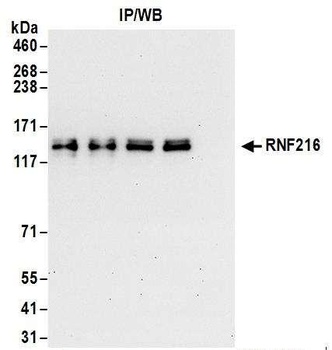 Rabbit anti-RNF216 Antibody, Affinity Purified