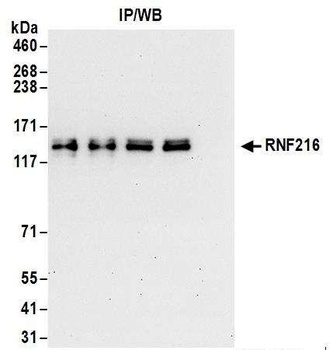 Rabbit anti-RNF216 Antibody, Affinity Purified