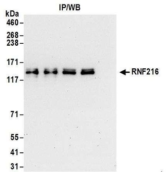 Rabbit anti-RNF216 Antibody, Affinity Purified