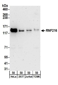 Rabbit anti-RNF216 Antibody, Affinity Purified
