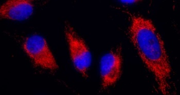 Rabbit anti-IDH2 Antibody, Affinity Purified