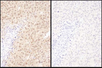 Rabbit anti-WWOX Antibody, Affinity Purified