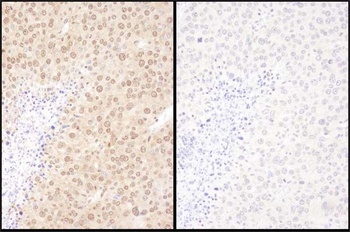 Rabbit anti-WWOX Antibody, Affinity Purified