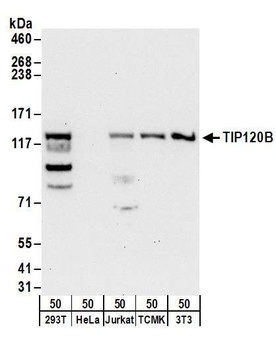 Rabbit anti-TIP120B Antibody, Affinity Purified