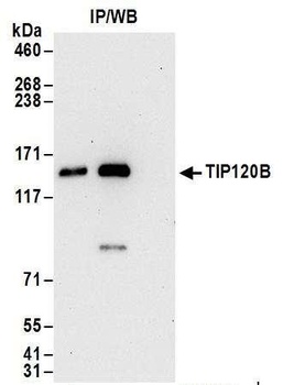 Rabbit anti-TIP120B Antibody, Affinity Purified