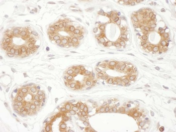 Rabbit anti-TMX1 Antibody, Affinity Purified