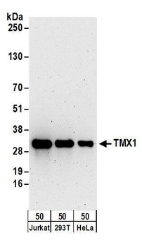 Rabbit anti-TMX1 Antibody, Affinity Purified