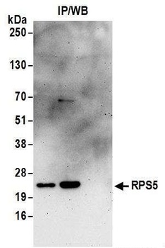 Rabbit anti-RPS5 Antibody, Affinity Purified