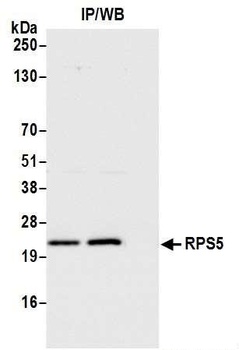 Rabbit anti-RPS5 Antibody, Affinity Purified
