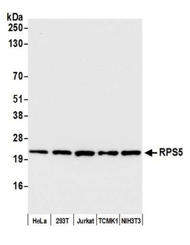 Rabbit anti-RPS5 Antibody, Affinity Purified