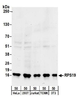 Rabbit anti-RPS19 Antibody, Affinity Purified