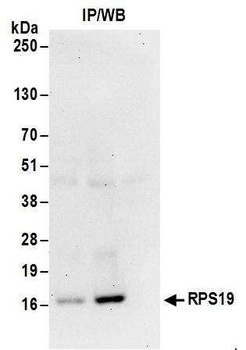 Rabbit anti-RPS19 Antibody, Affinity Purified