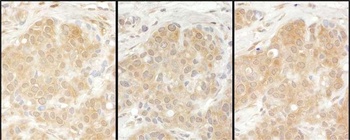 Rabbit anti-EPRS Antibody, Affinity Purified