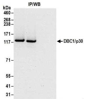 Goat anti-DBC1/p30 DBC Antibody, Affinity Purified