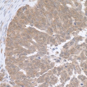 Rabbit anti-RPL5 Antibody, Affinity Purified