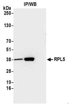 Rabbit anti-RPL5 Antibody, Affinity Purified