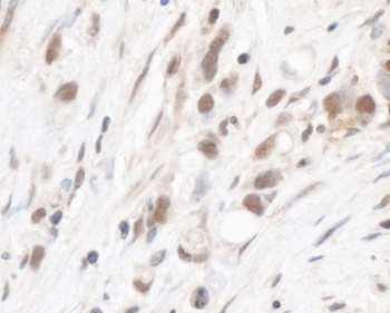 Rabbit anti-RPL5 Antibody, Affinity Purified