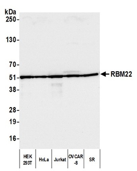 Rabbit anti-RBM22 Antibody, Affinity Purified
