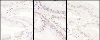 Rabbit anti-PRPF8 Antibody, Affinity Purified
