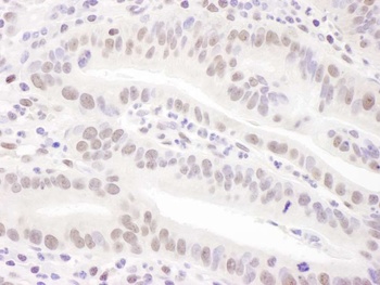 Rabbit anti-PRPF31 Antibody, Affinity Purified