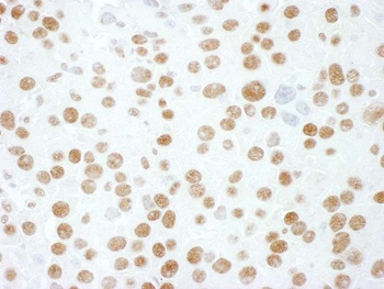 Rabbit anti-hnRNP M3/4 Antibody, Affinity Purified