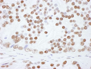 Rabbit anti-hnRNP-L Antibody, Affinity Purified