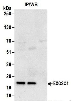 Rabbit anti-EXOSC1 Antibody, Affinity Purified