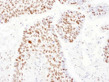 Rabbit anti-PSME3 Antibody, Affinity Purified