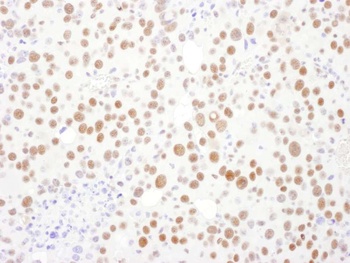 Rabbit anti-PSME3 Antibody, Affinity Purified