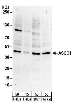 Rabbit anti-ASCC1 Antibody, Affinity Purified