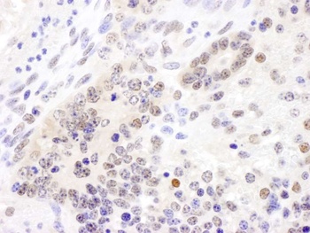 Rabbit anti-Cul4B Antibody, Affinity Purified