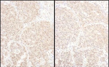 Rabbit anti-PSMD4 Antibody, Affinity Purified