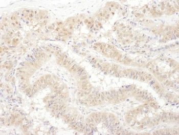 Rabbit anti-PSMC4 Antibody, Affinity Purified