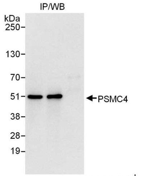 Rabbit anti-PSMC4 Antibody, Affinity Purified
