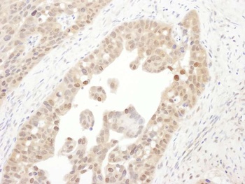 Rabbit anti-PSMC4 Antibody, Affinity Purified