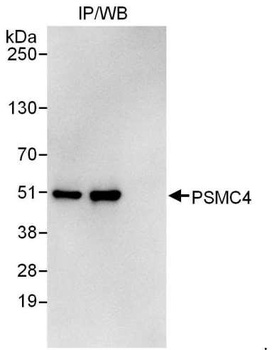 Rabbit anti-PSMC4 Antibody, Affinity Purified