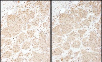 Rabbit anti-PSMA1 Antibody, Affinity Purified