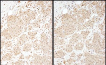 Rabbit anti-PSMA1 Antibody, Affinity Purified