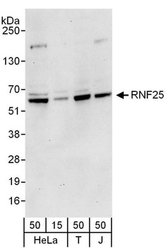 Rabbit anti-RNF25 Antibody, Affinity Purified