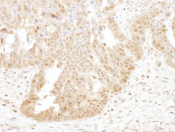 Rabbit anti-PSMB4 Antibody, Affinity Purified