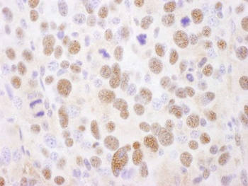 Rabbit anti-PSMA2 Antibody, Affinity Purified