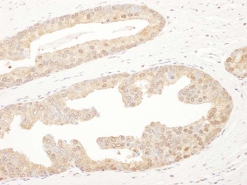 Rabbit anti-PSMA6 Antibody, Affinity Purified