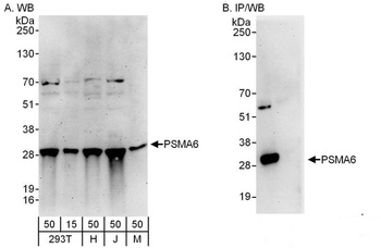 Rabbit anti-PSMA6 Antibody, Affinity Purified